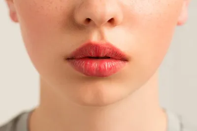 Коррекция губ гиалуроновой кислотой: цена в Москве на процедуру, увеличение  филлерами у косметолога