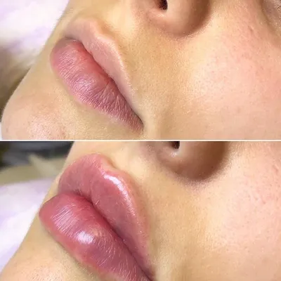 Идеальные губы: как выбрать подходящую форму