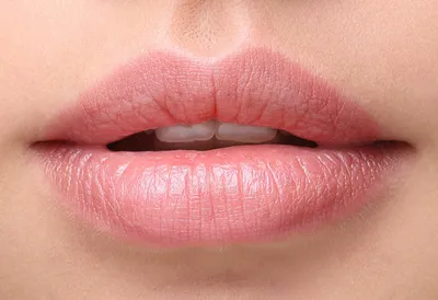 Контурная пластика губ в 2022 г | Ботокс губы, Инъекции губ, Формы губ |  Инъекции губ, Ботокс губы, Губы