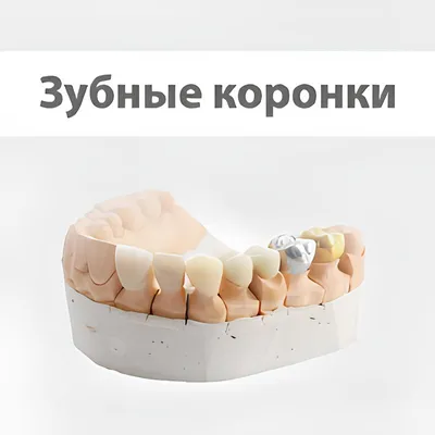 Прямая реставрация зубов в СПб. «Первая семейная клиника Петербурга»
