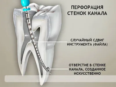 Корректор эмали Molecules цвет белый 20 мл по цене 302 ₽/шт. купить в  Москве в интернет-магазине Леруа Мерлен