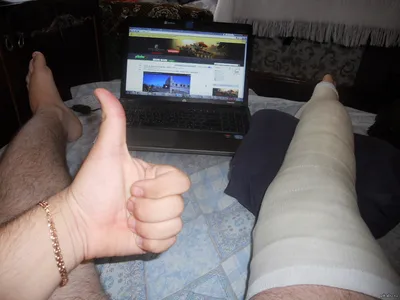 Как я сломала ногу, неудачно прокатившись на лонгборде
