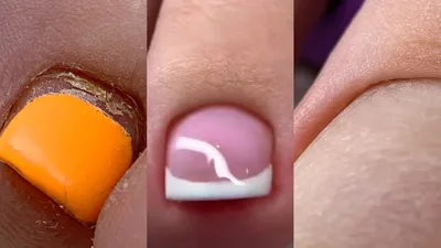 Накладные ногти для ног Kitty Nail, френч с розой, форма мягкий квадрат, 24  шт - купити за найкращою ціною в Україні ➤ KittyShop.com.ua