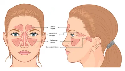 Гайморит у взрослых: симптомы, признаки, быстрая диагностика, эффективное  лечение