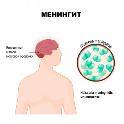 Синусит | Медицинский центр Святой Параскевы | Киев