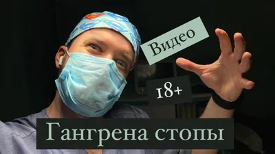 Атеросклероз нижних конечностей – облитерирующий и хронический - причина  онемения ног.