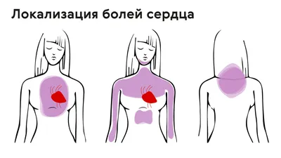 Боль в области сердца: симптомы, признаки, как понять, виды боли в сердце