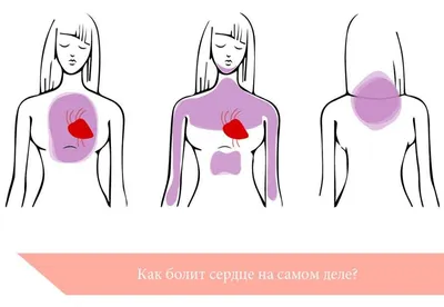 Как болит сердце на самом деле? | Здоровье вашего организма | Дзен