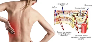 Болит живот или сердце? Абдоминальная форма инфаркта миокарда