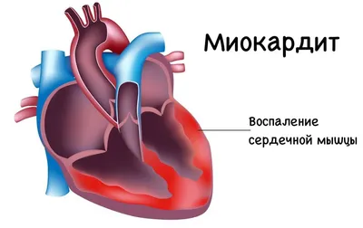 Как понять, что болит сердце? Рекомендации кардиолога