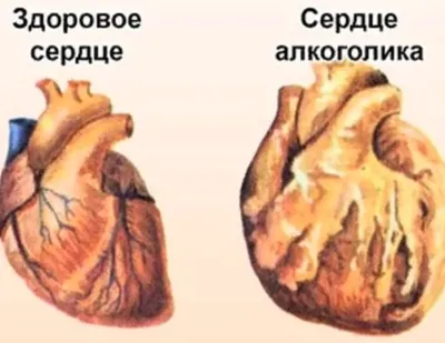 Моё сердце болит от любви... (Александр Айзенберг) / Стихи.ру