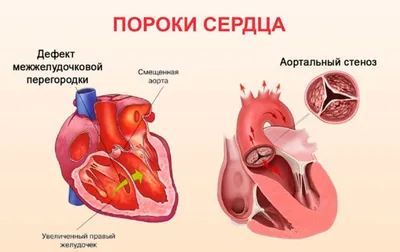 Сердце человека: как болит, где находится, сколько камер и другие  интересные и важные факты