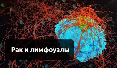 Почему в паху воспаляются лимфоузлы и что с ними делать - Лайфхакер