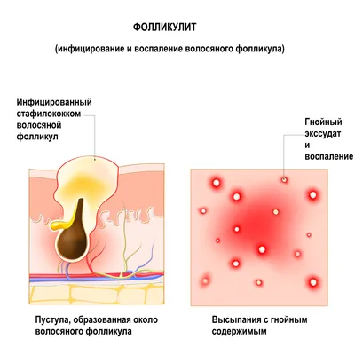 Lymphatic System