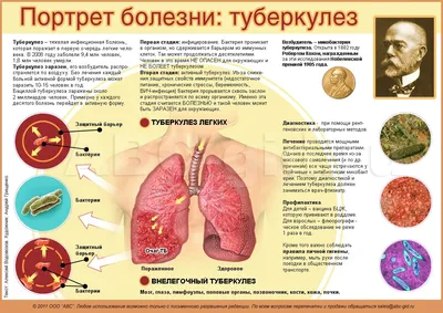 Уплотнения в области паха у детей | Клиника Фэнтези