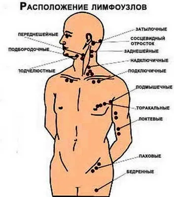 Почему в паху воспаляются лимфоузлы и что с ними делать?