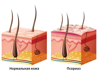 Чистка лимфы - как правильно чистить, зачем это делать, и способы.