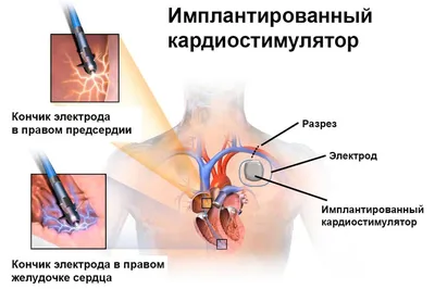 10.06.2022 В чьих руках находится сердце?