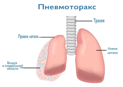 Анатомически человеческое сердце, …» — создано в Шедевруме