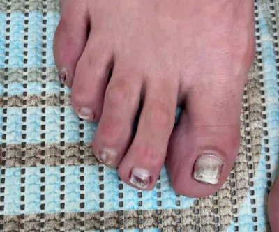 Педикюр 🖤 | Toe nails, Toe nail designs, Pretty toe nails