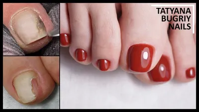 💅ПЕДИКЮР сама себе💅Покрытие НОГТЕЙ НА НОГАХ гель лаком💅Дизайн ногтей гель  лаком💅 - YouTube