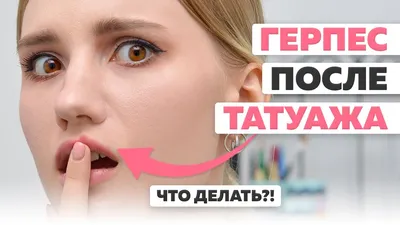 Герпес на губах после татуажа: причины и лечение