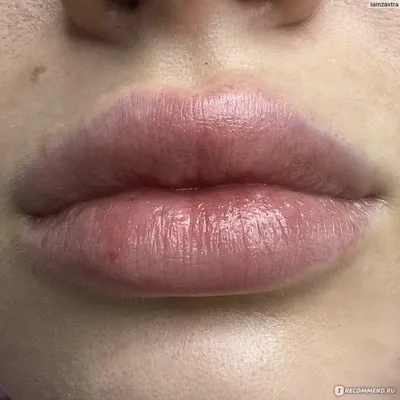 Фотография герпеса после татуажа губ: как обезболить