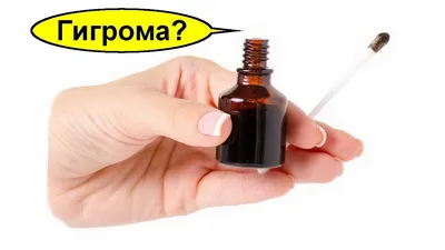 Гигрома на пальце руки: фото для исследования