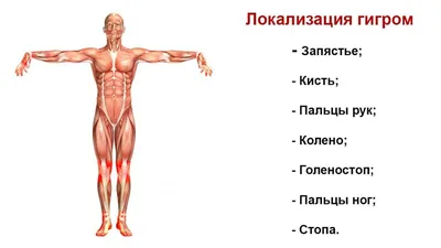 Изображение гигромы на суставе пальца руки в черно-белом стиле