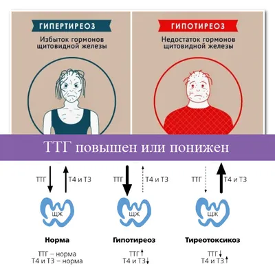 Гипотиреоз картинки фотографии