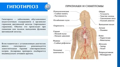 Учреждение здравоохранения \"Щучинская центральная районная больница\" -  Гипотиреоз