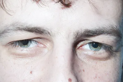 Глаза Наркомана фотографии