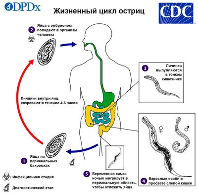 Глисты у ребёнка: причины, симптомы, диагностика и лечение гельминтов у  детей