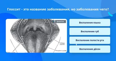 Трещины на языке - причины и лечение. Симптомы глоссита.