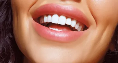 My City Dentist - 💥ГОЛЛИВУДСКАЯ УЛЫБКА с 50% скидкой в течении 48 часов 🕝  💙Красивая улыбка — не только здоровые зубы, это исцеление разума, сердца и  секрет сохранения молодости. ⠀⠀⠀⠀⠀⠀⠀⠀⠀⠀⠀⠀⠀⠀⠀⠀⠀⠀ 😁Ты тоже