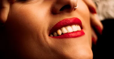 Голливудская улыбка в стоматологической клинике