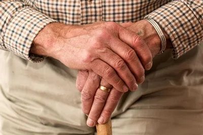 Изображение грибка на ногтях рук у пациента, принимающего гормональные препараты