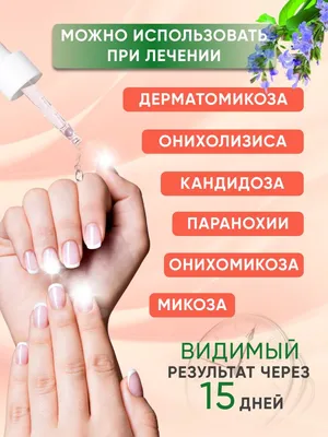 Фотографии грибка на ногтях рук: какие есть препараты от заболевания