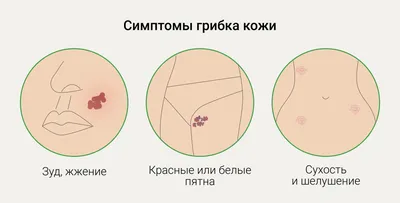 Грибок-паразит превращает самцов мух в некрофилов