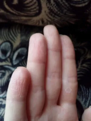 Красивое изображение грибка на подушечках пальцев рук