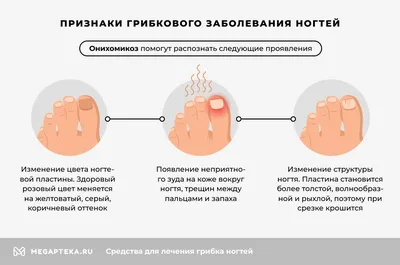 Медицинский педикюр при грибке ногтей | Где в Москве сделать чистку  грибковых ногтей