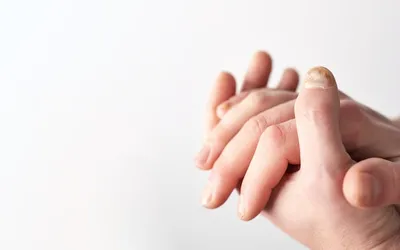 Фото грибка ногтей на руках: как предотвратить заражение