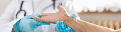 Фото грибка ногтя на руке для медицинских целей