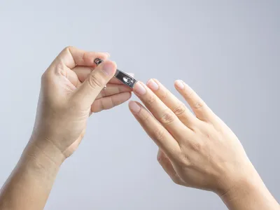 Размеры фото грибка ногтей рук для сайтов косметологов