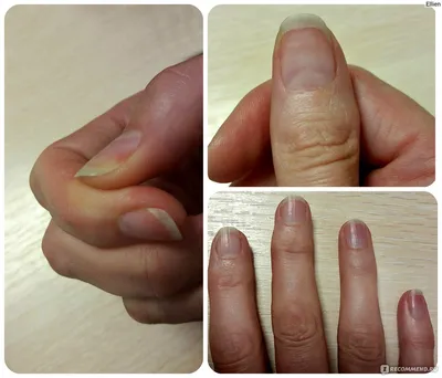 Фотография грибка пальцев рук на белом фоне с использованием эффекта кросс-обработки