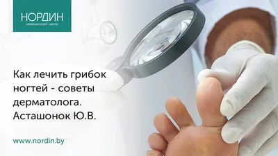 Изображения грибка под ногтями рук: как определить симптомы