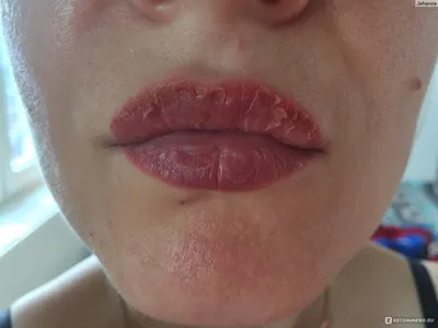 Фото губ после татуажа с использованием теней