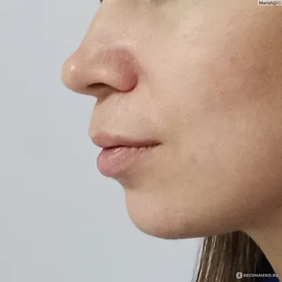 Фото губ после татуажа в аппликации
