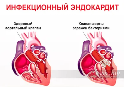 Детский сад № 4 «Золотая рыбка»