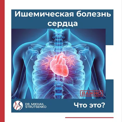 Ишемическая болезнь сердца — что это, причины, симптомы, лечение | Блог |  Complimed